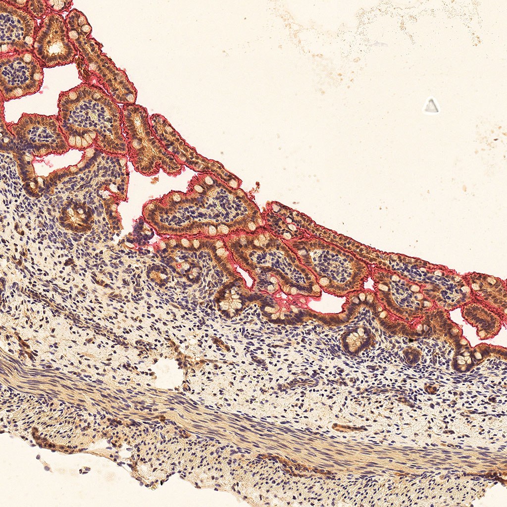 sars-cov-2 gene expression in a human fetus